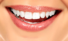 Cosmetic Dentistry